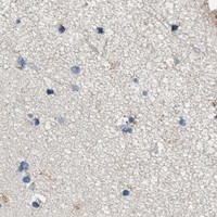 HPA IHC Cerebral cortex — ACADVL