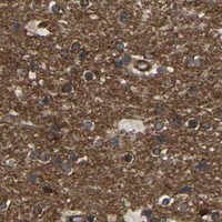 HPA IHC Cerebral cortex — PICALM