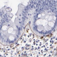 HPA IHC Colon — LAMC1