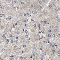 HPA IHC Liver — AIMP2
