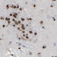 HPA IHC Caudate — QKI