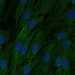 HPA019136: hTERT-RPE1 (serum starved)