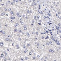 HPA IHC Liver — PREX1