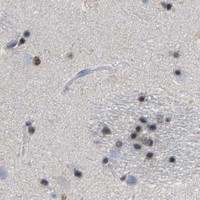 HPA IHC Caudate — OLIG2