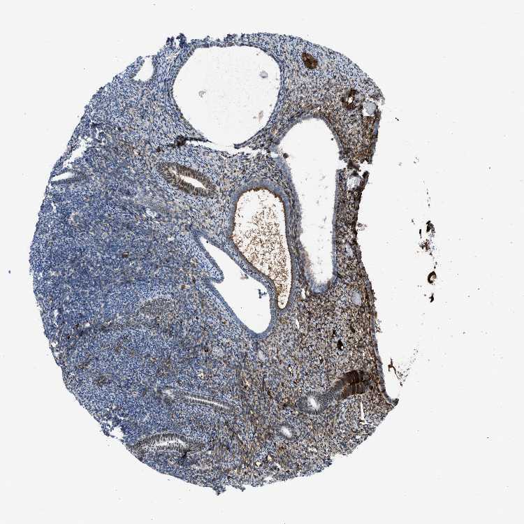 Tissue expression of LEF1 Staining in endometrium The Human Protein