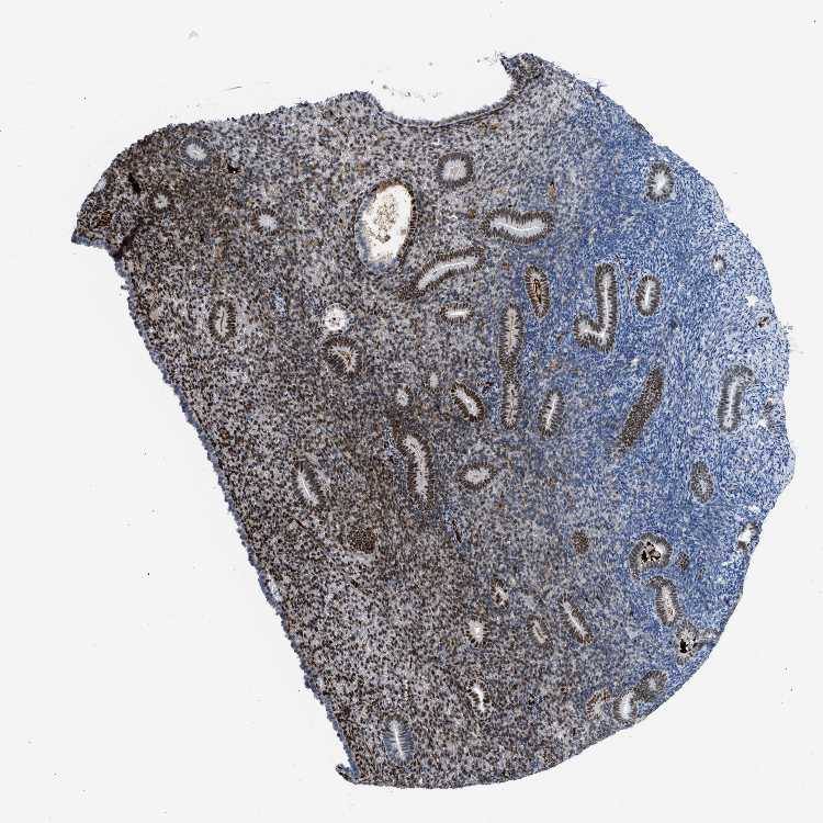 Tissue expression of LEF1 Staining in endometrium The Human Protein