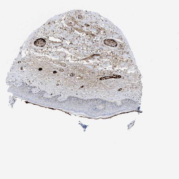Tissue expression of LEF1 Staining in skin The Human Protein Atlas