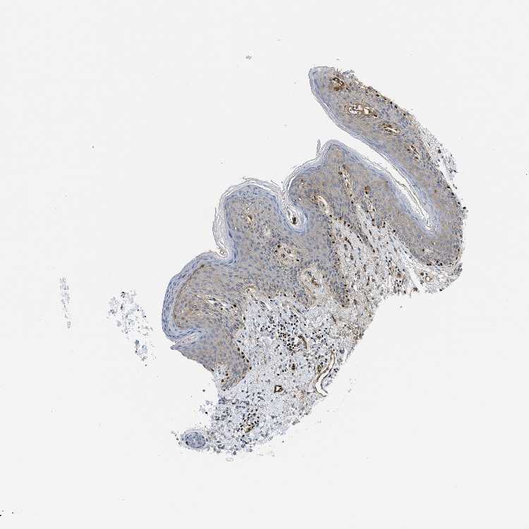 Tissue expression of LEF1 Staining in skin The Human Protein Atlas