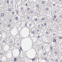 HPA IHC Liver — BCL10
