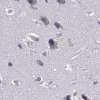 HPA IHC Cerebral cortex — BCL10