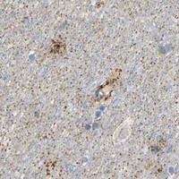 HPA IHC Cerebral cortex — HIBADH