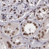 HPA IHC Kidney — RCOR1