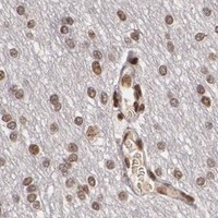 HPA IHC Cerebral cortex — RCOR1