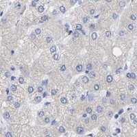 HPA IHC Liver — STRIP2