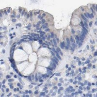 HPA IHC Colon — STRIP2