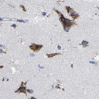 HPA IHC Cerebral cortex — STRIP2