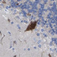 HPA IHC Cerebellum — STRIP2