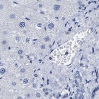 HPA IHC Liver — TPR
