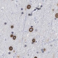 HPA IHC Cerebral cortex — TPR