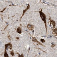 HPA IHC Cerebral cortex — FAM120A