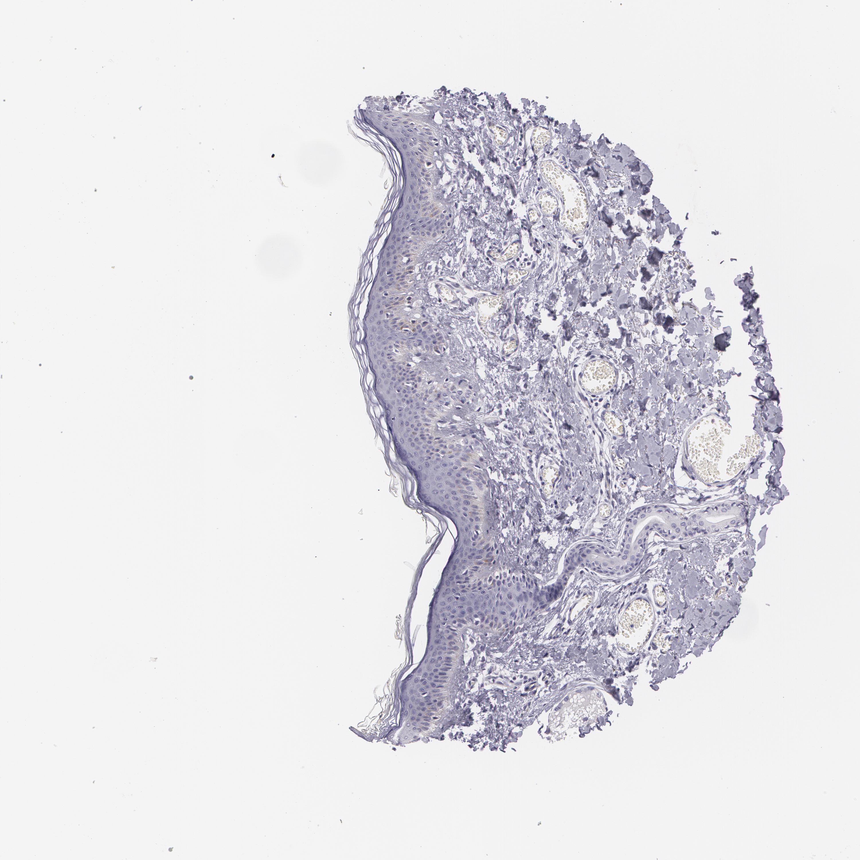 Tissue expression of MAP2 Staining in skin The Human Protein Atlas