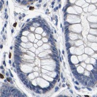 HPA IHC Colon — RAB27B