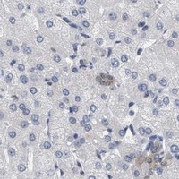 HPA IHC Liver — RUVBL1