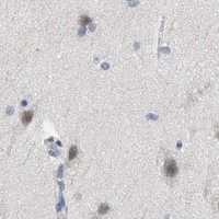 HPA IHC Cerebral cortex — RUVBL1