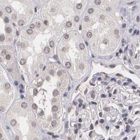 HPA IHC Kidney — THRB