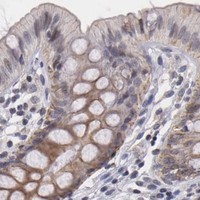 HPA IHC Colon — THRB