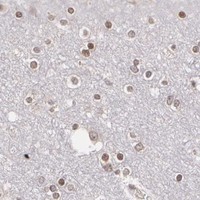 HPA IHC Cerebral cortex — THRB