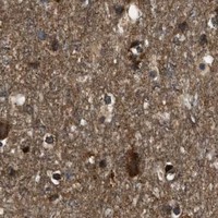 HPA IHC Cerebral cortex — PNPLA8