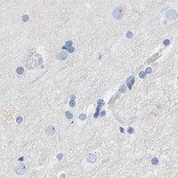 HPA IHC Cerebral cortex — PEX1