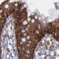 HPA IHC Colon — ERLIN2