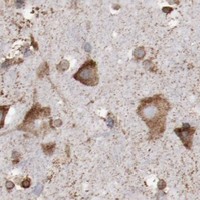 HPA IHC Cerebral cortex — ERLIN2
