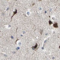 HPA IHC Cerebral cortex — SLIRP
