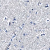 HPA IHC Cerebral cortex — ERBB2