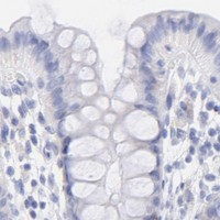 HPA IHC Colon — C1QTNF6