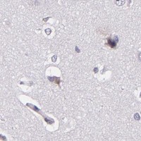 HPA IHC Cerebral cortex — HSP90AA1