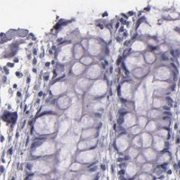 HPA IHC Colon — INA
