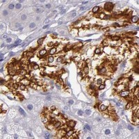 HPA IHC Adrenal gland — INA