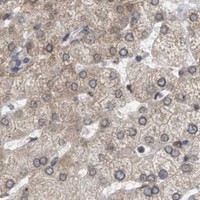 HPA IHC Liver — NUP62