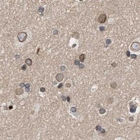 HPA IHC Cerebral cortex — NUP62