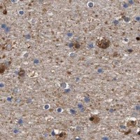 HPA IHC Cerebral cortex — ALDOC