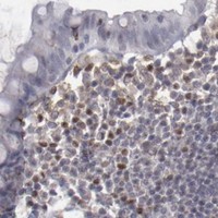 HPA IHC Colon — LEF1