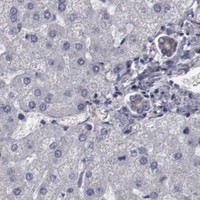 HPA IHC Liver — LEF1