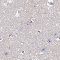 HPA IHC Cerebral cortex — LEF1
