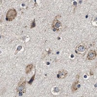 HPA IHC Cerebral cortex — SFXN4