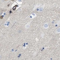 HPA IHC Cerebral cortex — ASS1
