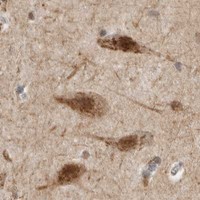 HPA IHC Cerebral cortex — ZMYND8